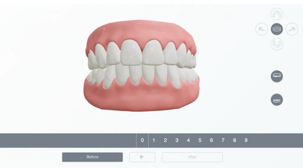 intraoral scanner