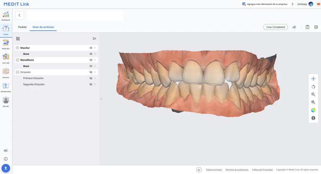 3D occlusal splint
