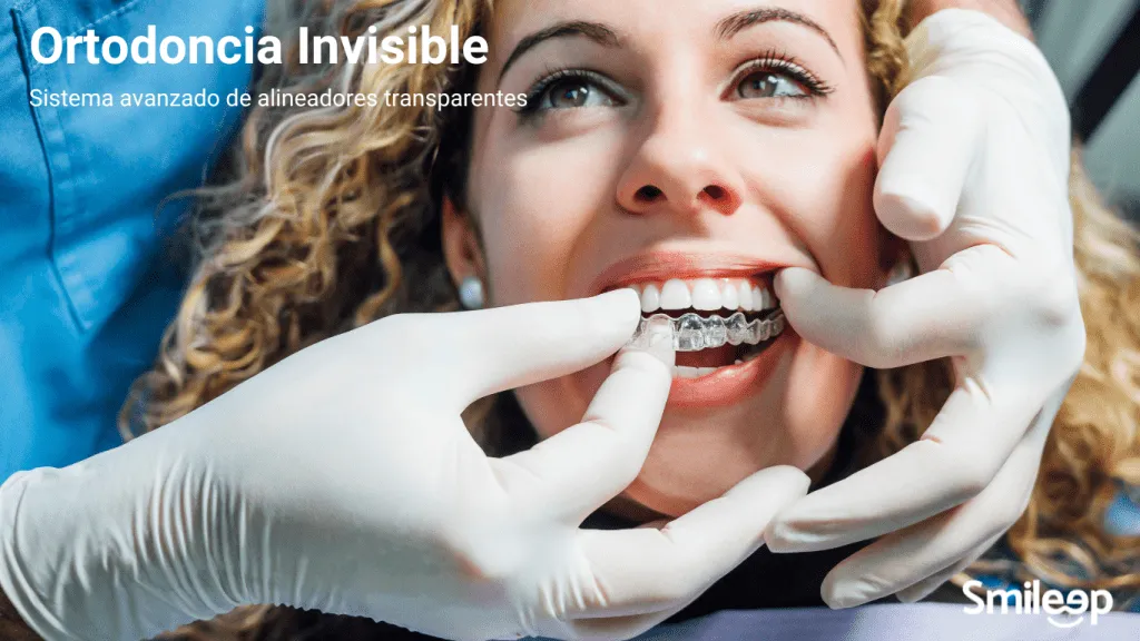 clear aligners
