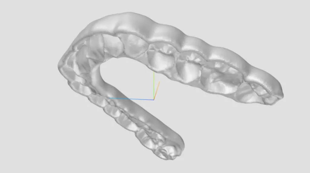digital-3d-occlusal-splint
