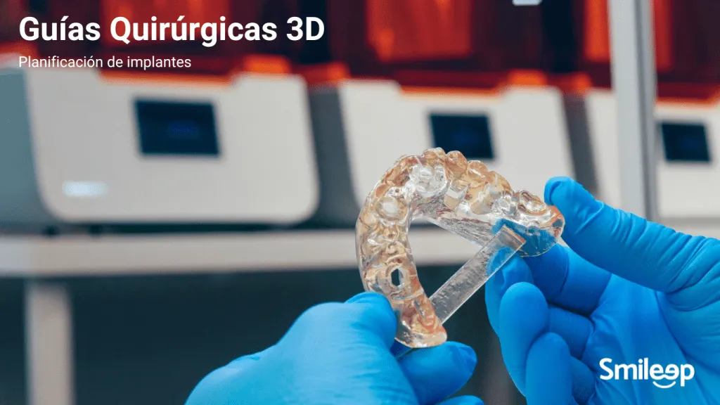 3D Surgical Guides