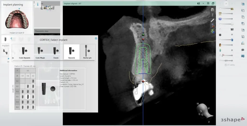 3D surgical guides