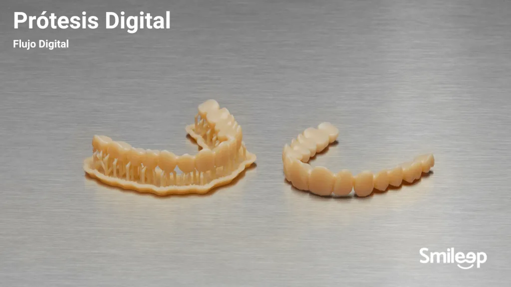 3D dental prosthesis