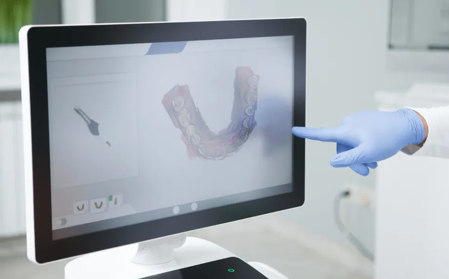Scanner dentário 3D