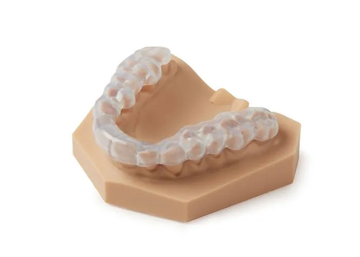 Occlusal splint made through a digital workflow.