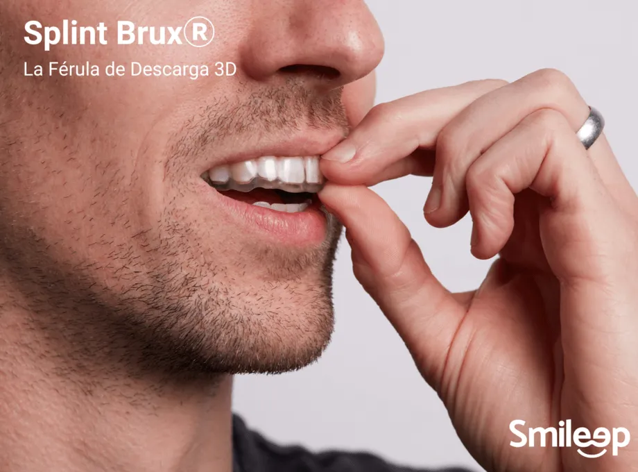 Digital Bruxism Splints in 48 h: Precision and Clinical Value