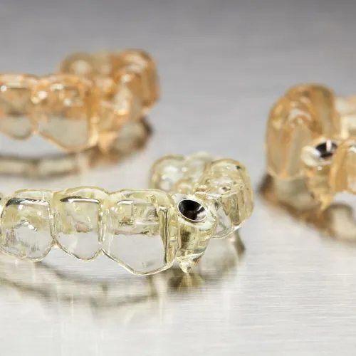 Guia cirúrgico 3D para implantes dentários impresso com tecnologia digital
