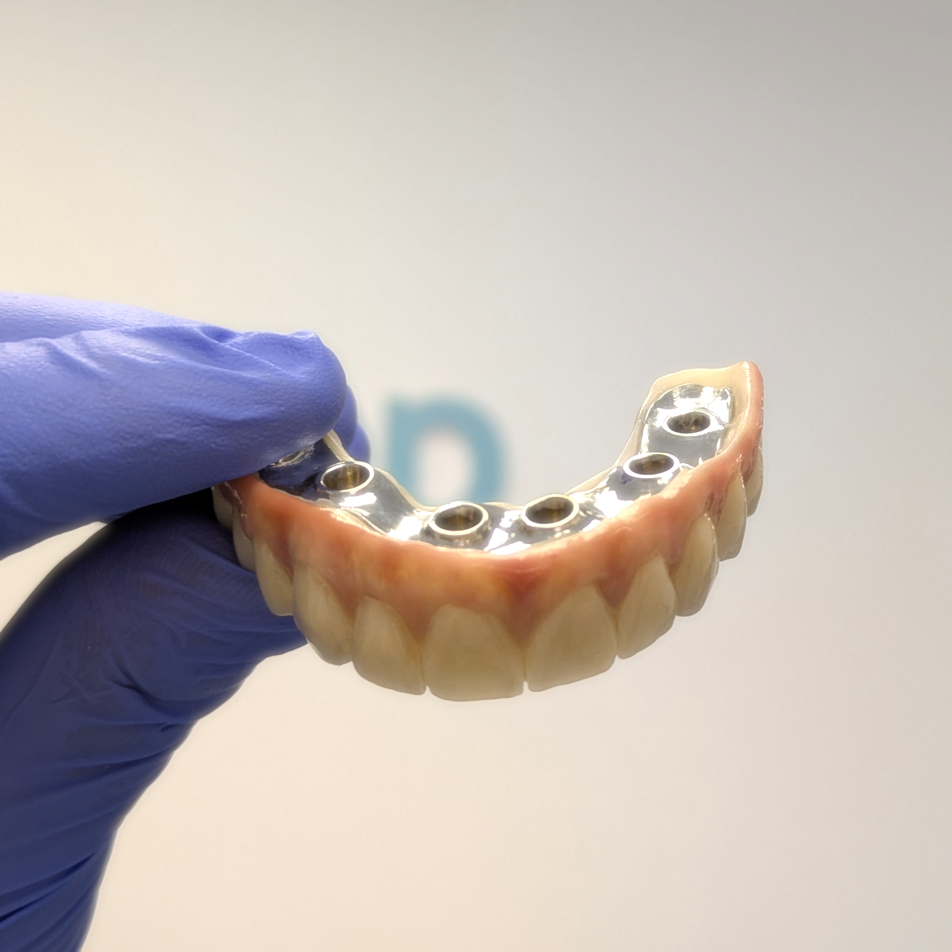 Implant Prosthetics CAD-CAM Dental Laboratory | Smileep